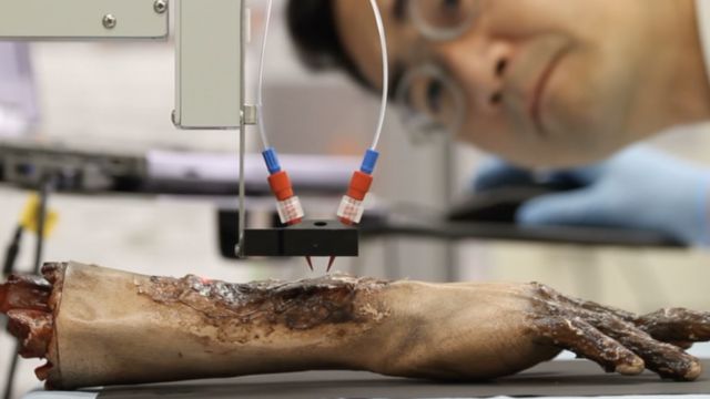 Тест нанесения кожи на обожженную рану