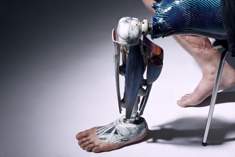 бионика в человеке, искусственная нога